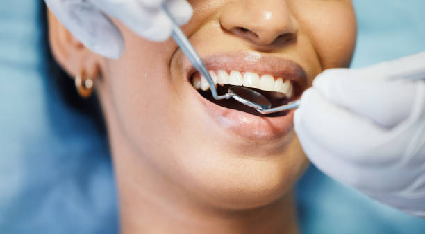 Best Emergency Wisdom Teeth Removal in Unionville, GA