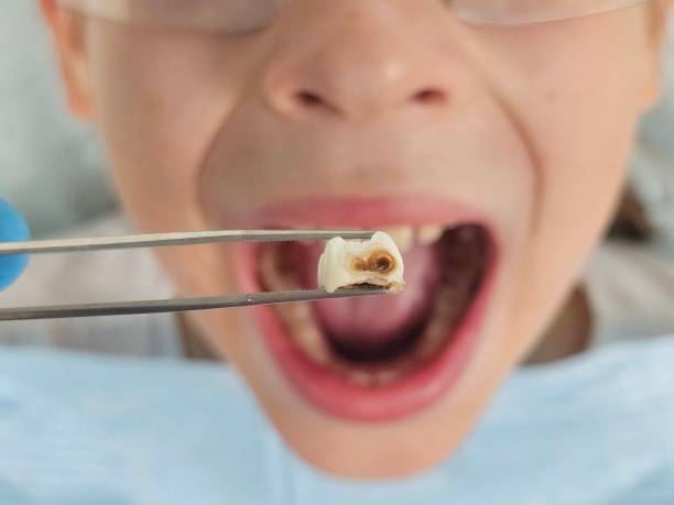 Best After-Hours Emergency Dentist in Unionville, GA